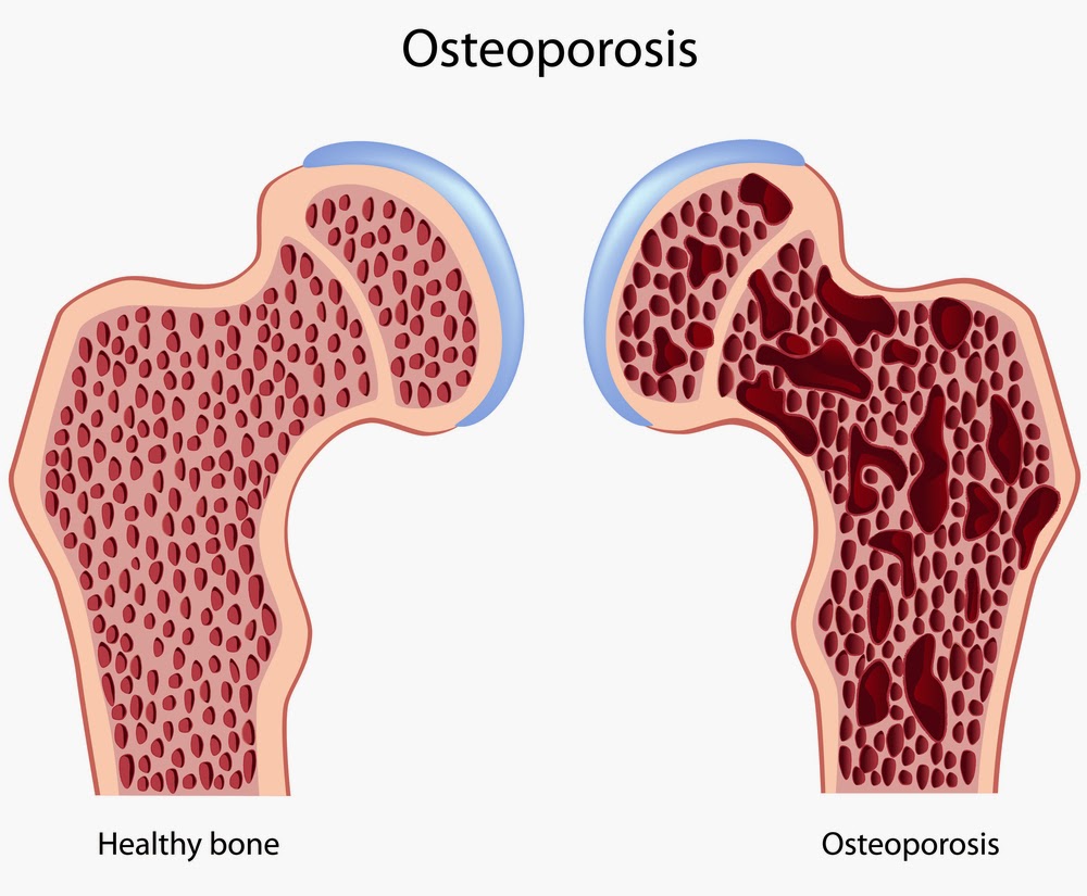 problemas oseos perros osteoporosis